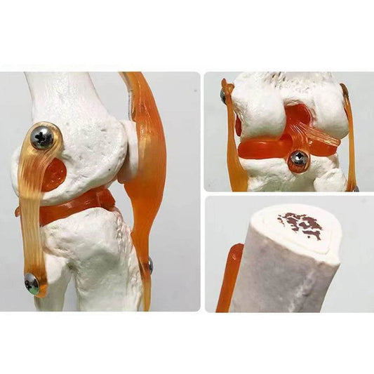 1:1 Lifesize Adult Human Knee Joint Anatomy Model Medical Science Teaching Resources Student Anatomia Humana Classroom Supplies - ToylandEU