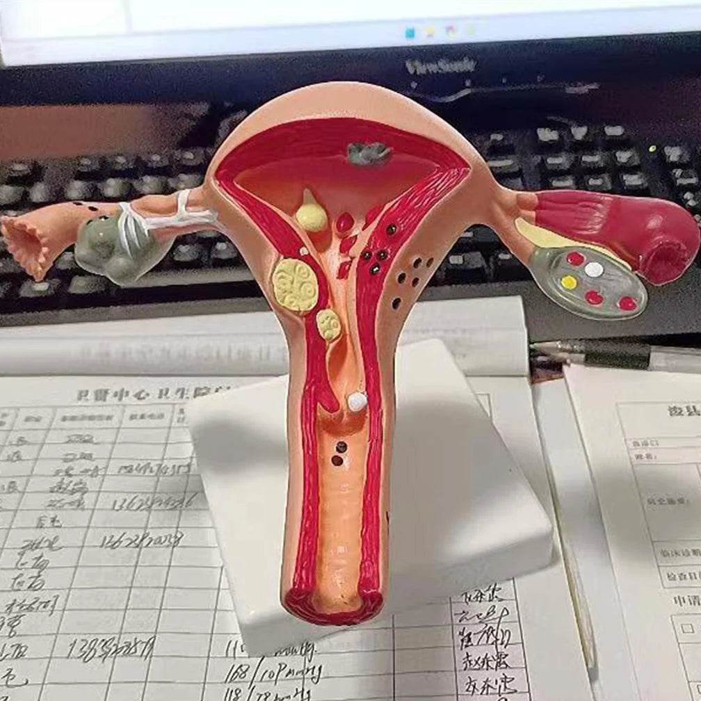 Cross Section Structure Model Human Pathological Uterus Ovary Model Uterus  Anatomical Anatomy Female Organ Teaching Study Tool ToylandEU, image size:1008x1008