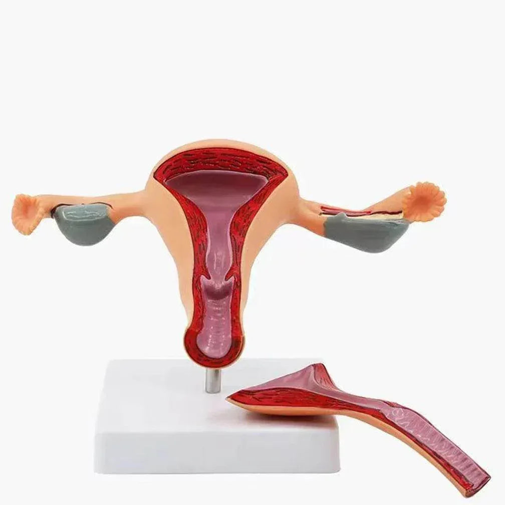 Cross Section Structure Model Human Pathological Uterus Ovary Model Uterus Anatomical Anatomy Female Organ Teaching Study Tool - ToylandEU