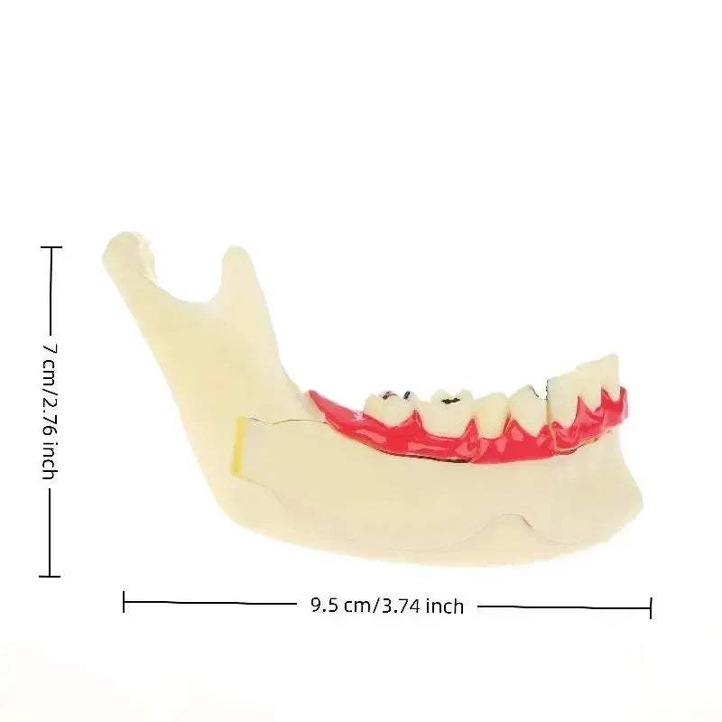 Dental Endodontic Gum Anatomy Model With Openable Gums - ToylandEU