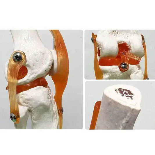  1 1 Flexible Knee Joint Model with Ligaments and Base Femur Tibia Fibula Bones Medical Teaching -  ToylandEU™