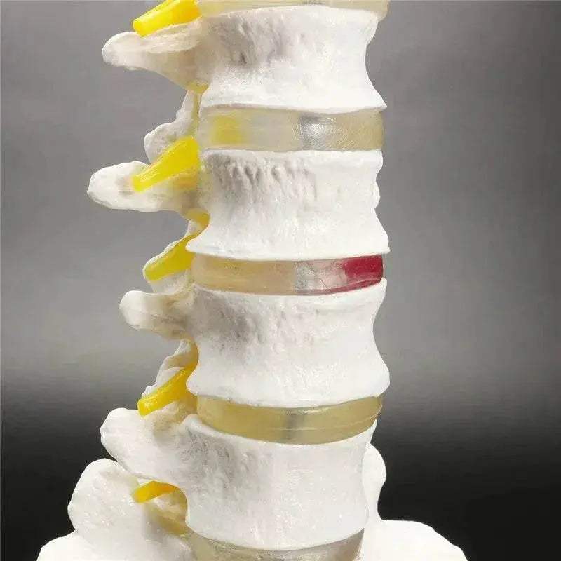 13cm Life Size Chiropractic Human Anatomical Lumbar Vertebral Spine Model School Educational Medical Teaching Tool - ToylandEU