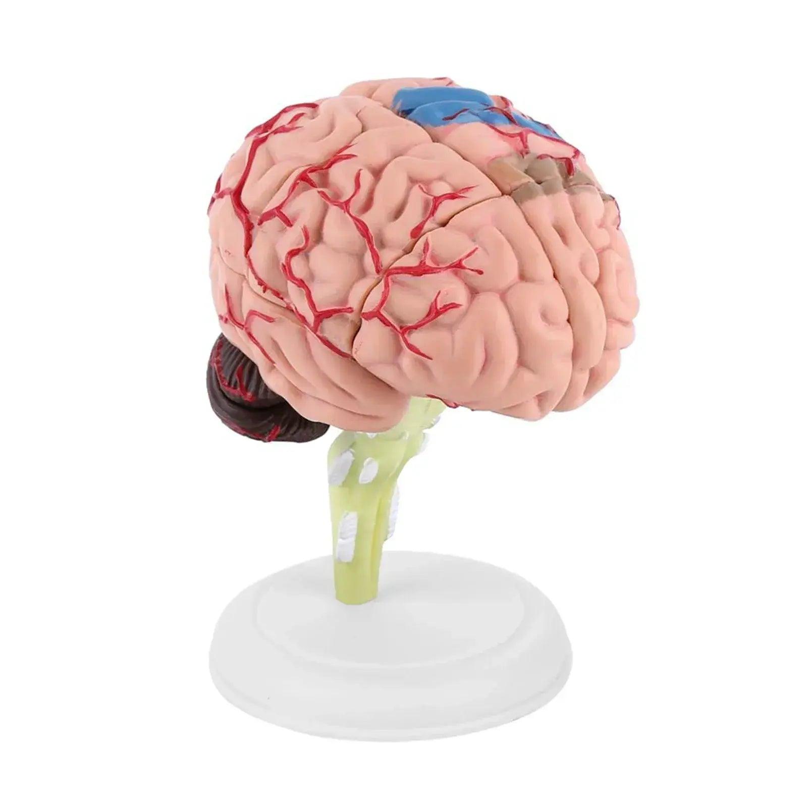  Anatomical Brain Model Lightweight Medical Tool -  ToylandEU™