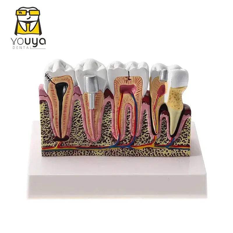 Anatomical Dental Teaching Model For Comprehensive Study - ToylandEU