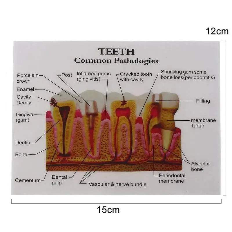 Anatomical Dental Teaching Model For Comprehensive Study - ToylandEU