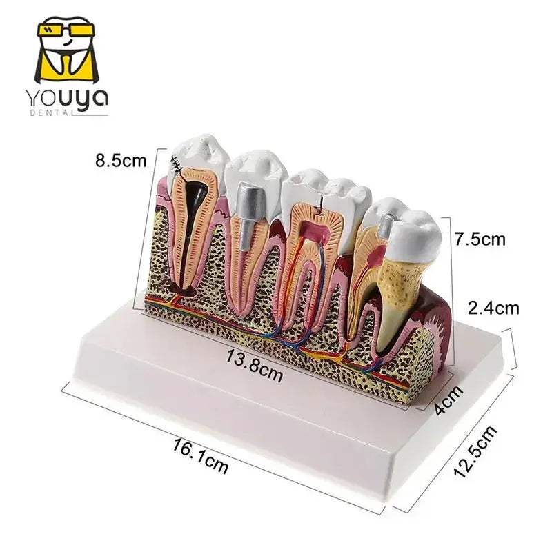 Anatomical Dental Teaching Model For Comprehensive Study - ToylandEU