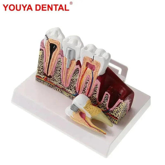  Anatomical Dental Teaching Model Resin For Education -  ToylandEU™
