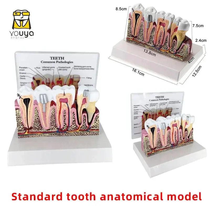  Anatomical Dental Teaching Model Resin For Education -  ToylandEU™