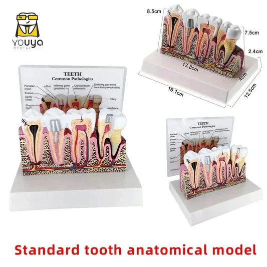  Anatomical Dental Teaching Model Resin For Education -  ToylandEU™