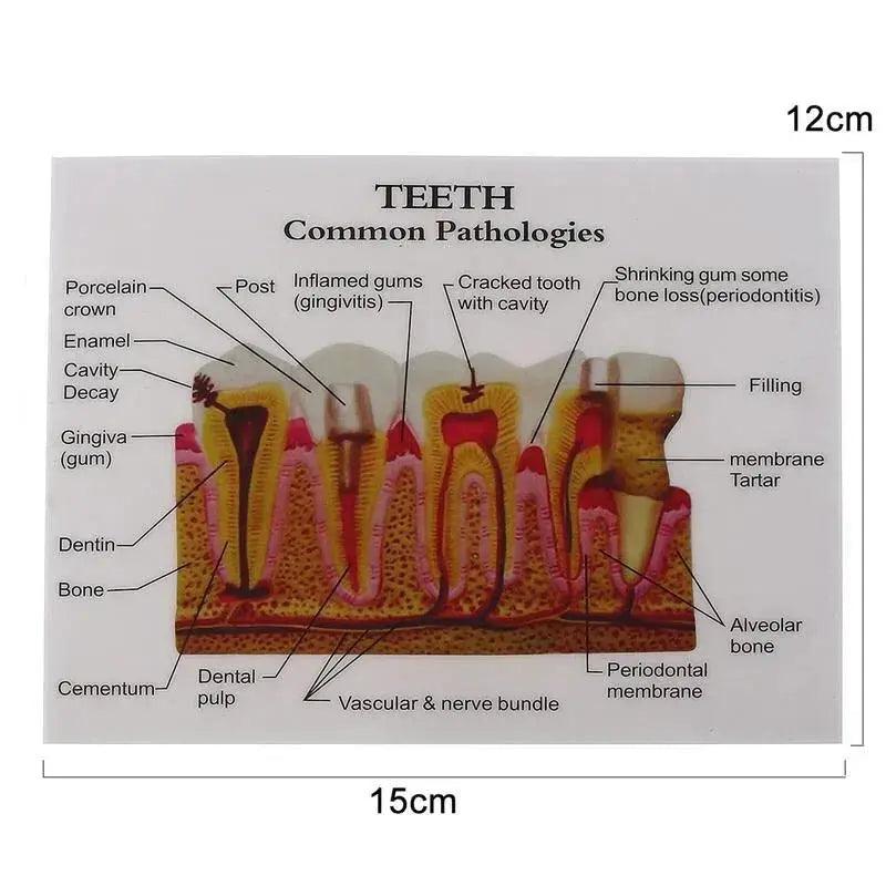  Anatomical Dental Teaching Model Resin For Education -  ToylandEU™