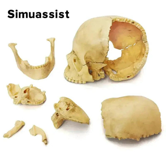  Anatomy Skull Model 15 Piece Detachable Parts -  ToylandEU™