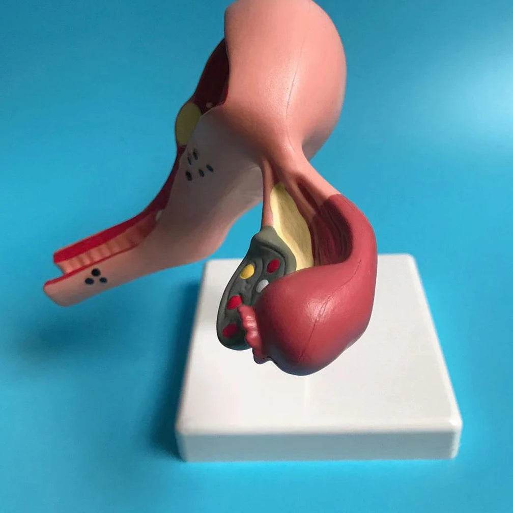 Cross Section Structure Model Human Pathological Uterus Ovary Model Uterus Anatomical Anatomy Female Organ Teaching Study Tool - ToylandEU