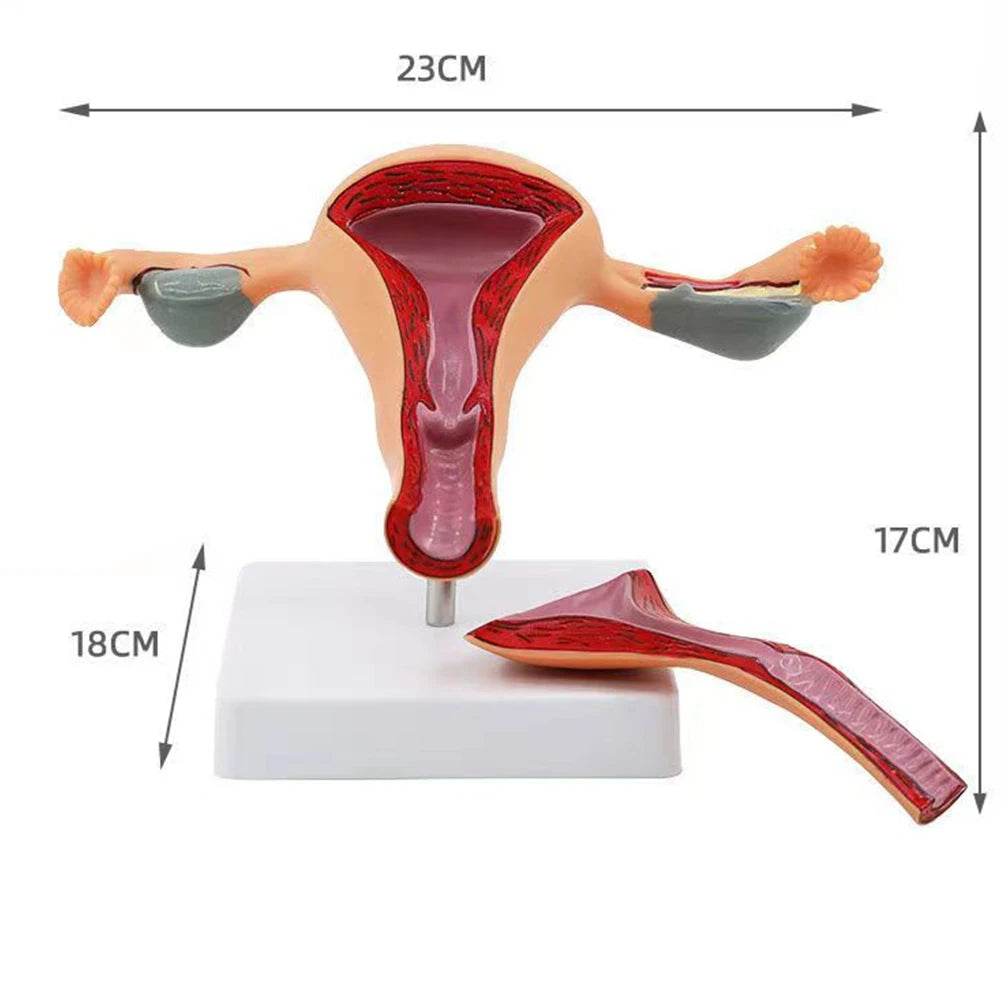 Cross Section Structure Model Human Pathological Uterus Ovary Model Uterus Anatomical Anatomy Female Organ Teaching Study Tool - ToylandEU