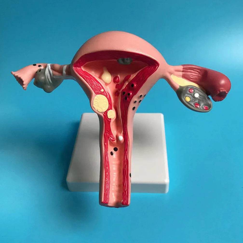 Cross Section Structure Model Human Pathological Uterus Ovary Model Uterus Anatomical Anatomy Female Organ Teaching Study Tool - ToylandEU