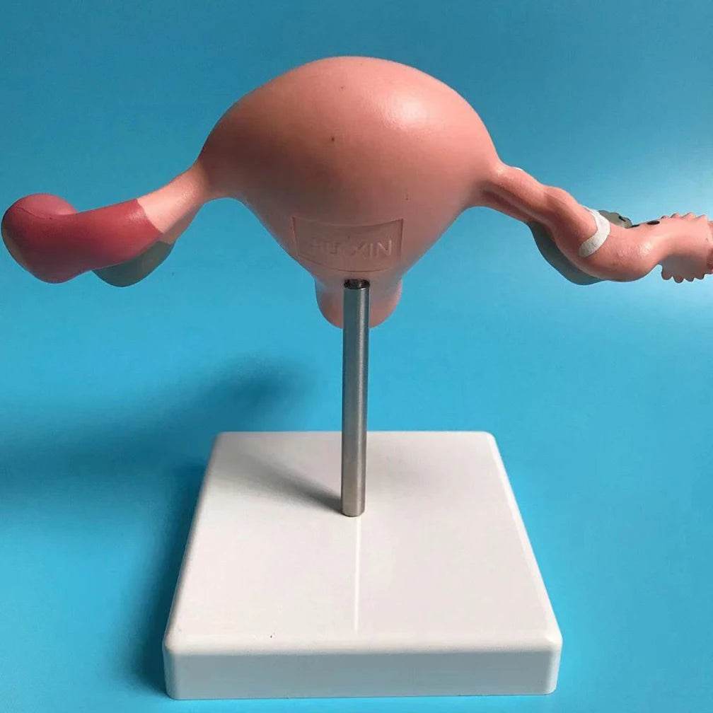 Cross Section Structure Model Human Pathological Uterus Ovary Model Uterus Anatomical Anatomy Female Organ Teaching Study Tool - ToylandEU