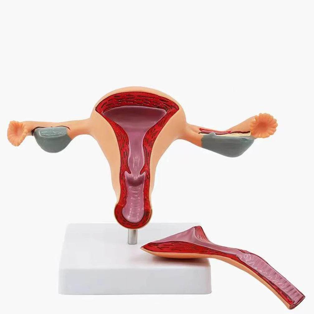 Cross Section Structure Model Human Pathological Uterus Ovary Model Uterus Anatomical Anatomy Female Organ Teaching Study Tool - ToylandEU