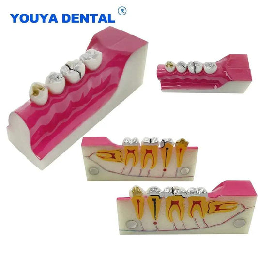  Dental Anatomy Model Molar Cross Section For Teaching -  ToylandEU™