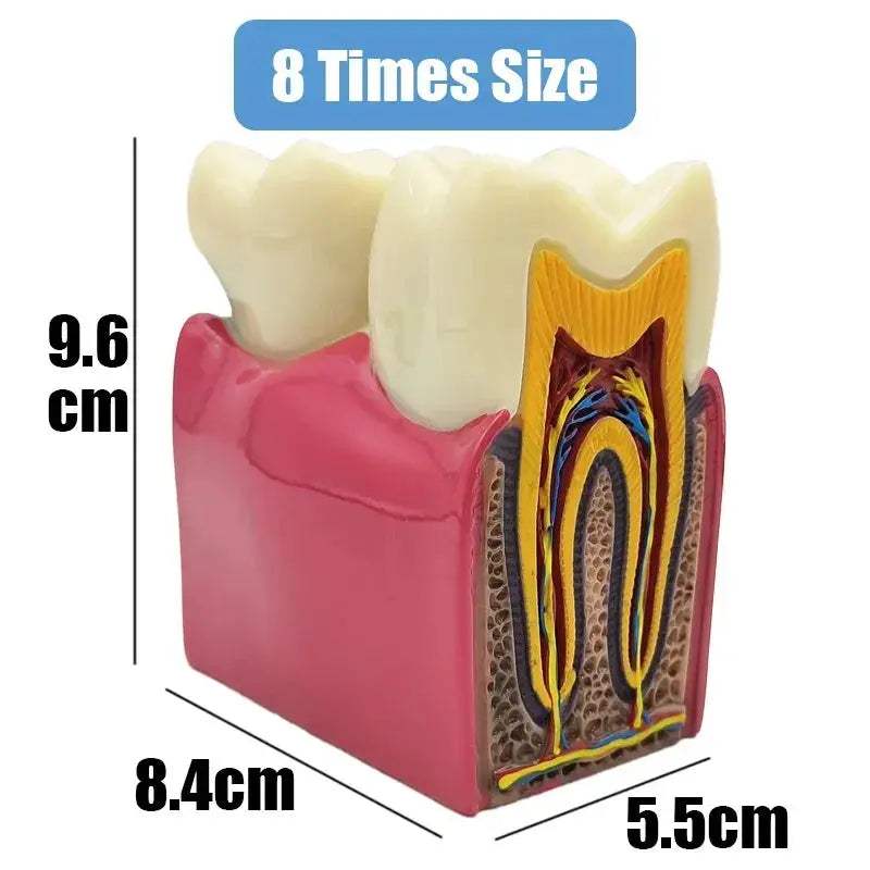 Dental Caries Demonstration Model For Teaching And Lab - ToylandEU