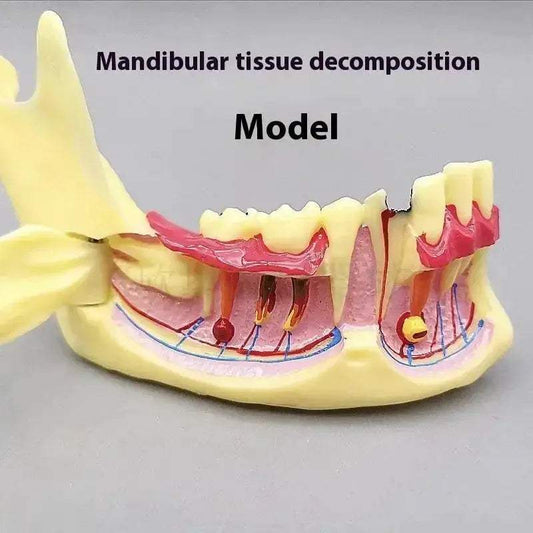  Dental Endodontic Gum Anatomy Model With Openable Gums -  ToylandEU™