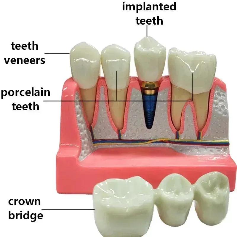  Dental Typodont Teaching Model With Removable Teeth -  ToylandEU™