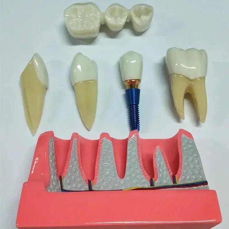  Dental Typodont Teaching Model With Removable Teeth -  ToylandEU™