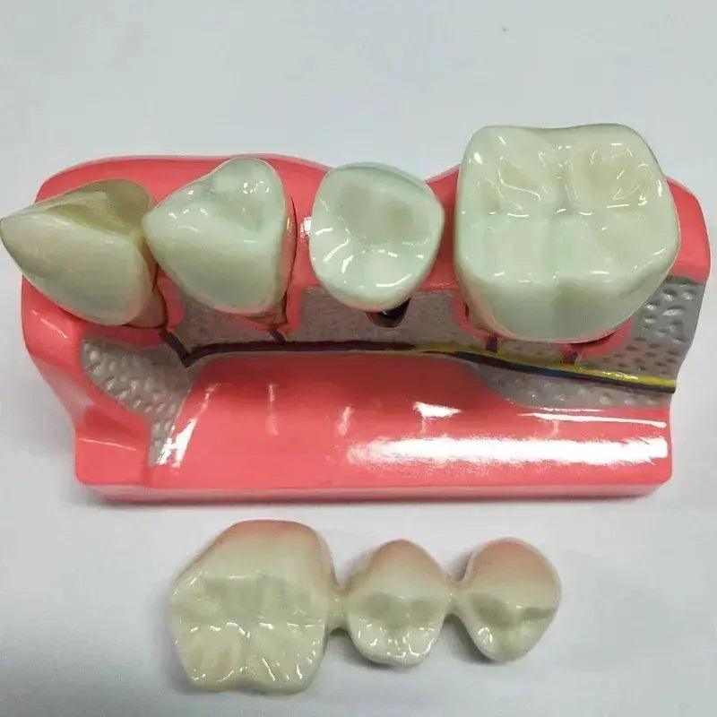 Dental Typodont Teaching Model With Removable Teeth -  ToylandEU™