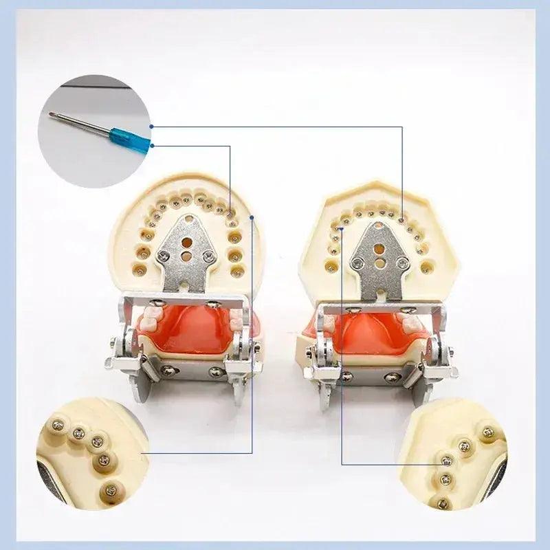  Dental Typodont Teaching Model With Removable Teeth -  ToylandEU™