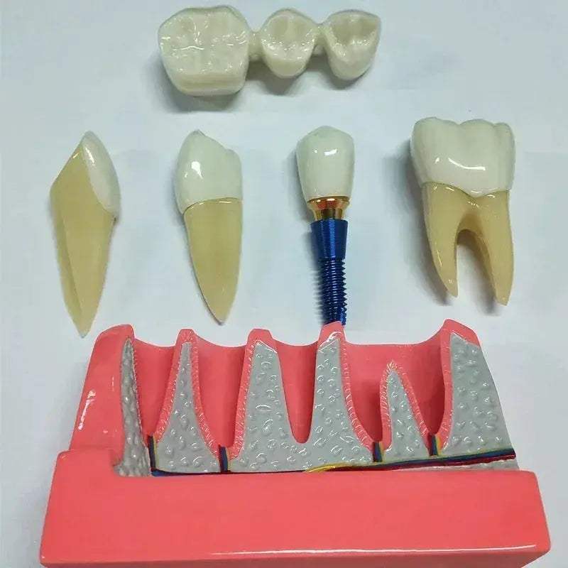 Dental Typodont Teaching Model With Removable Teeth - ToylandEU