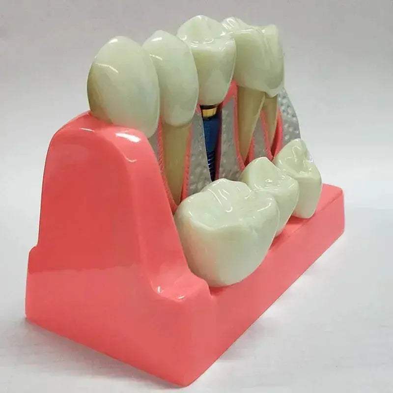 Dental Typodont Teaching Model With Removable Teeth - ToylandEU