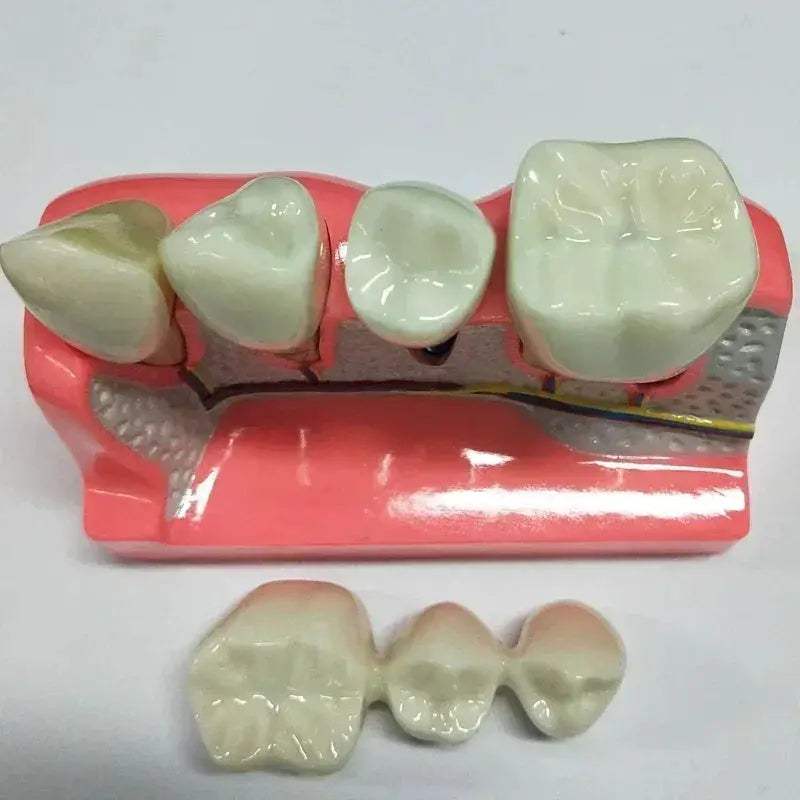 Dental Typodont Teaching Model With Removable Teeth - ToylandEU
