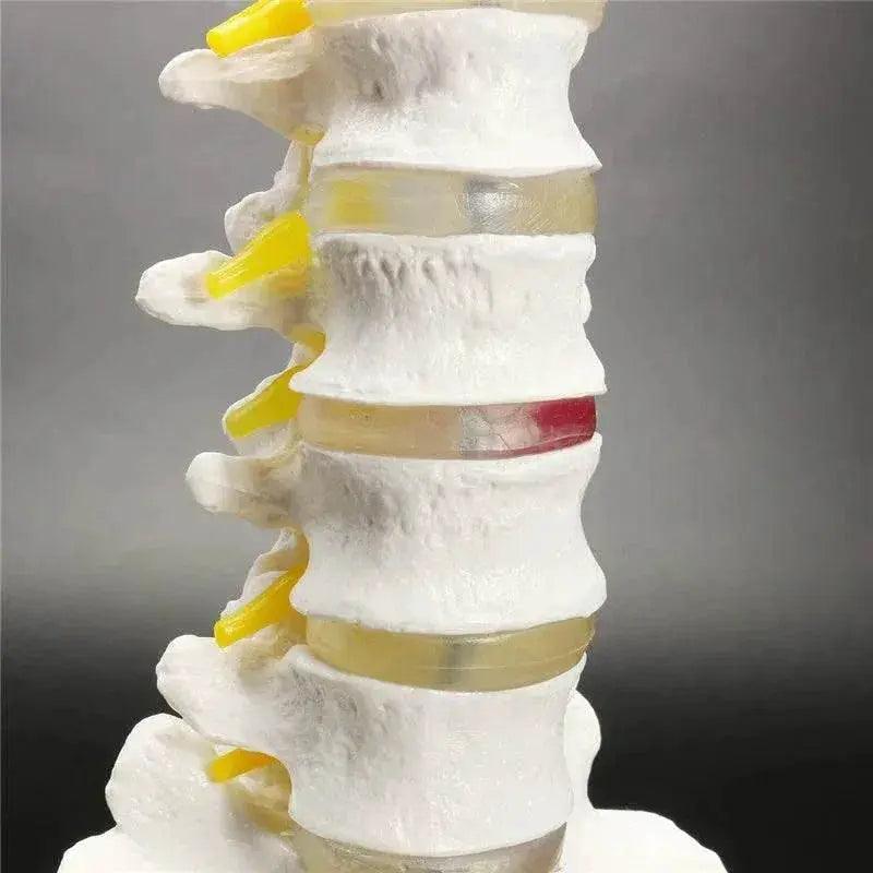  13cm Life Size Chiropractic Human Anatomical Lumbar Vertebral Spine Model School Educational Medical Teaching Tool -  ToylandEU™
