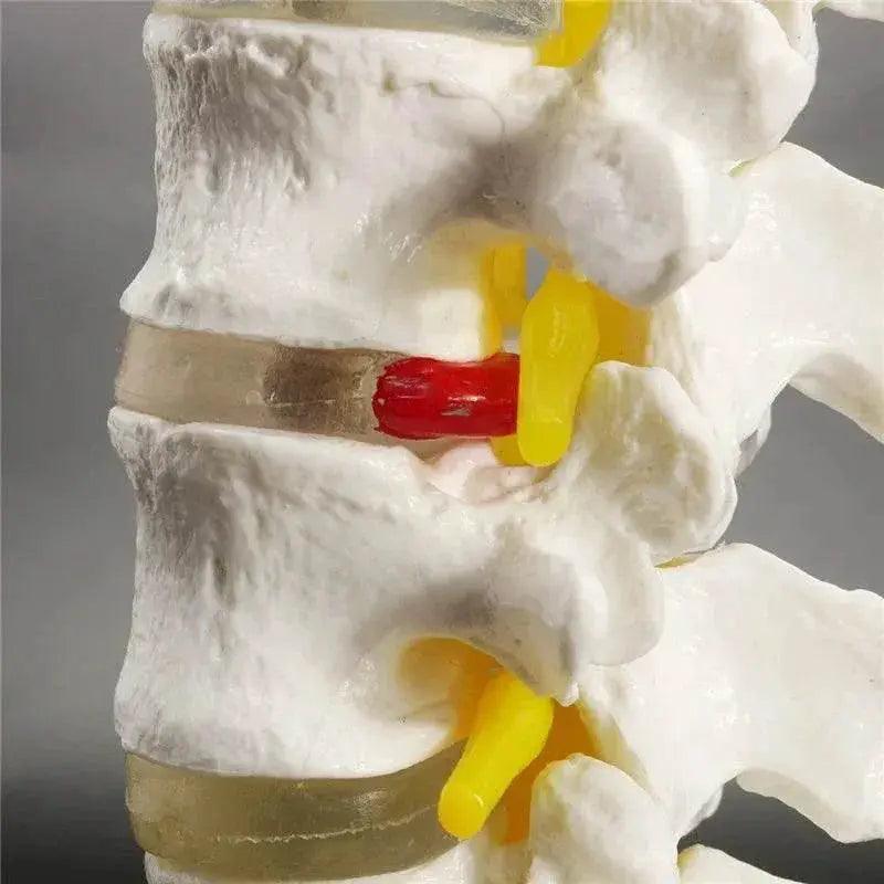  13cm Life Size Chiropractic Human Anatomical Lumbar Vertebral Spine Model School Educational Medical Teaching Tool -  ToylandEU™