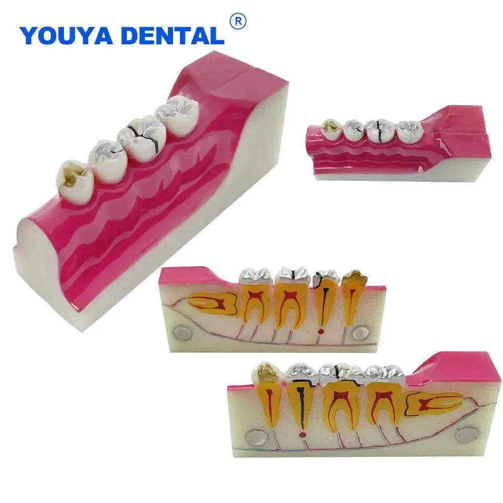  Dental Anatomy Model Molar Cross Section For Teaching -  ToylandEU™