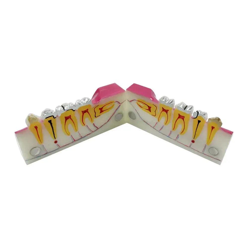  Dental Anatomy Model Molar Cross Section For Teaching -  ToylandEU™