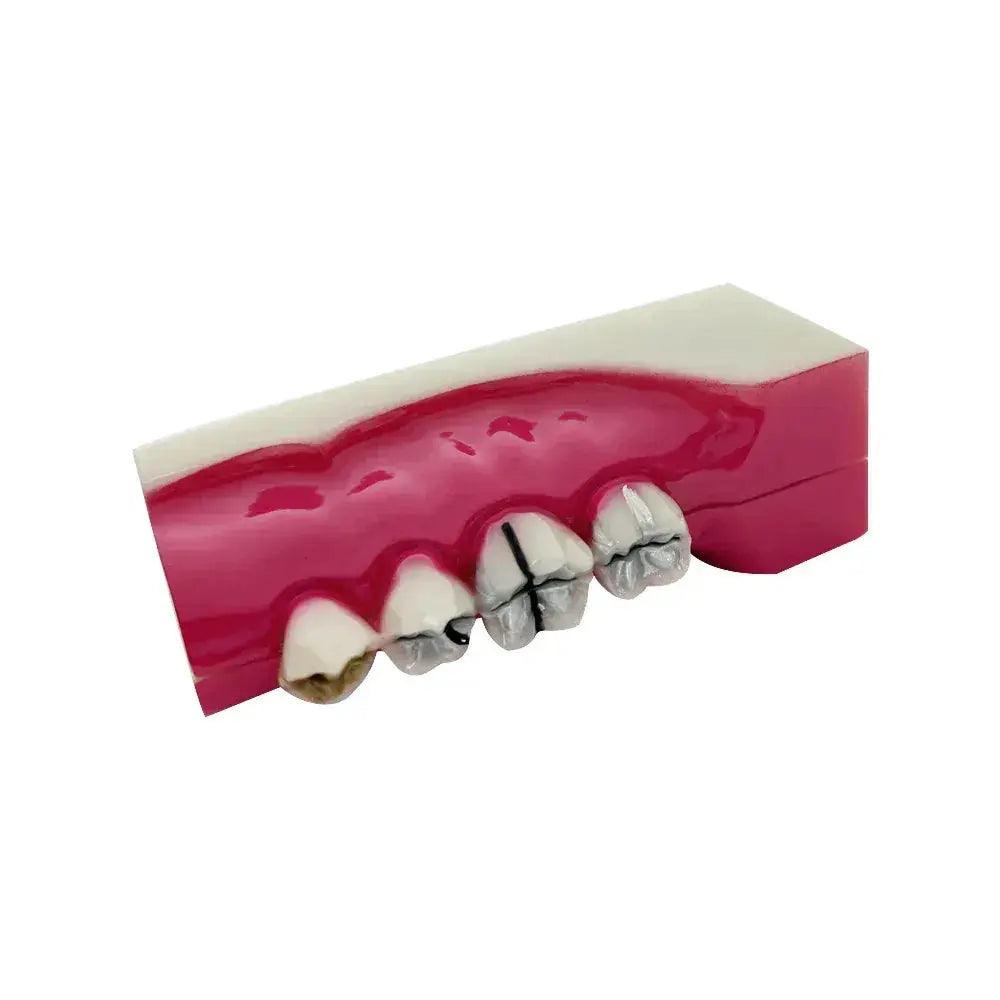  Dental Anatomy Model Molar Cross Section For Teaching -  ToylandEU™
