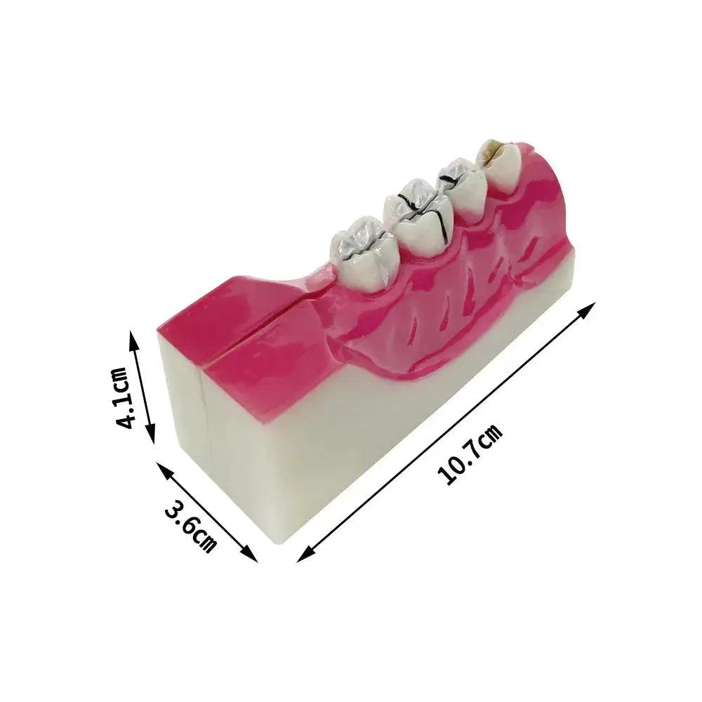  Dental Anatomy Model Molar Cross Section For Teaching -  ToylandEU™