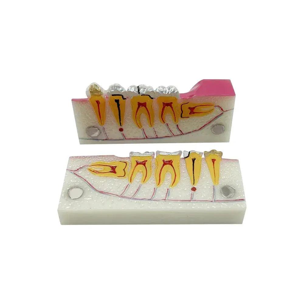  Dental Anatomy Model Molar Cross Section For Teaching -  ToylandEU™