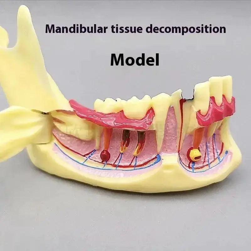  Dental Endodontic Gum Anatomy Model With Openable Gums -  ToylandEU™