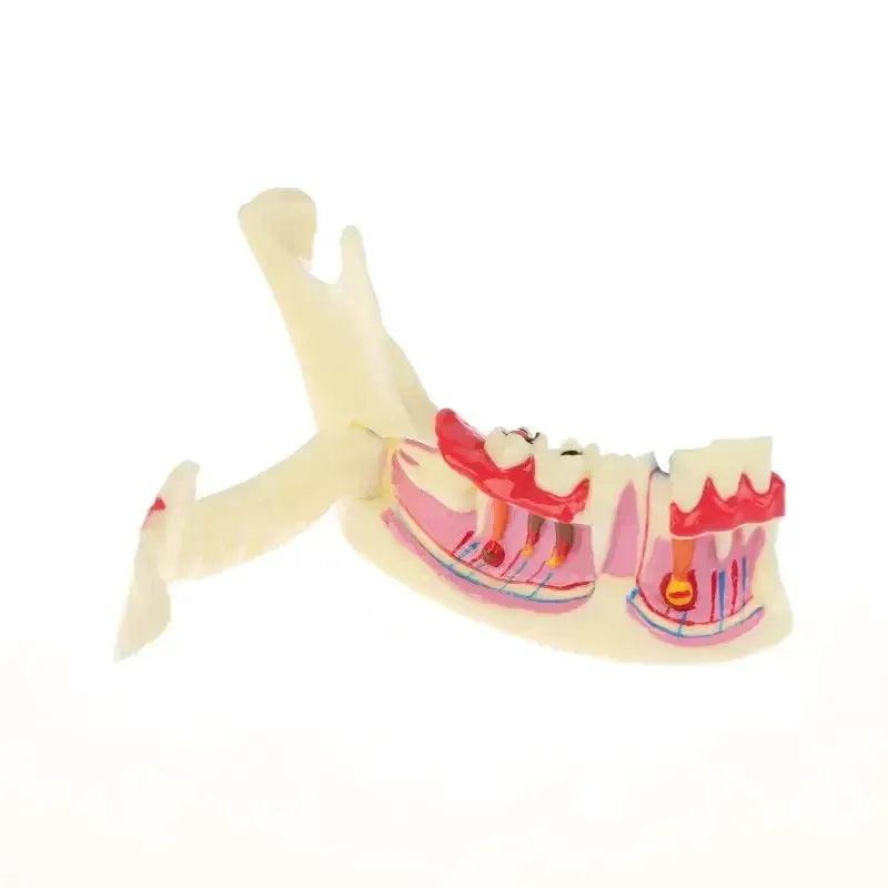  Dental Endodontic Gum Anatomy Model With Openable Gums -  ToylandEU™