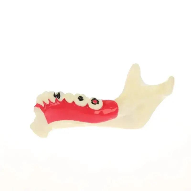  Dental Endodontic Gum Anatomy Model With Openable Gums -  ToylandEU™