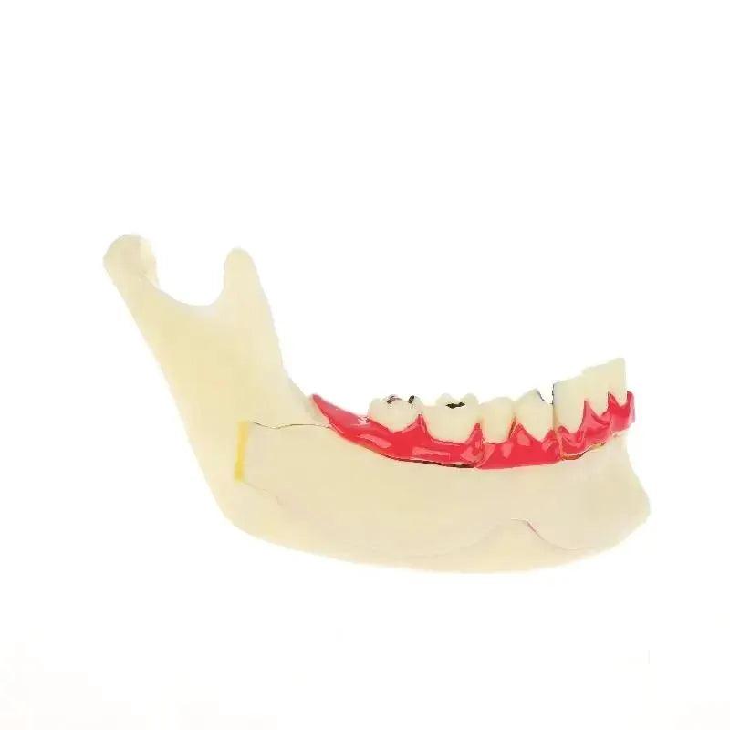  Dental Endodontic Gum Anatomy Model With Openable Gums -  ToylandEU™