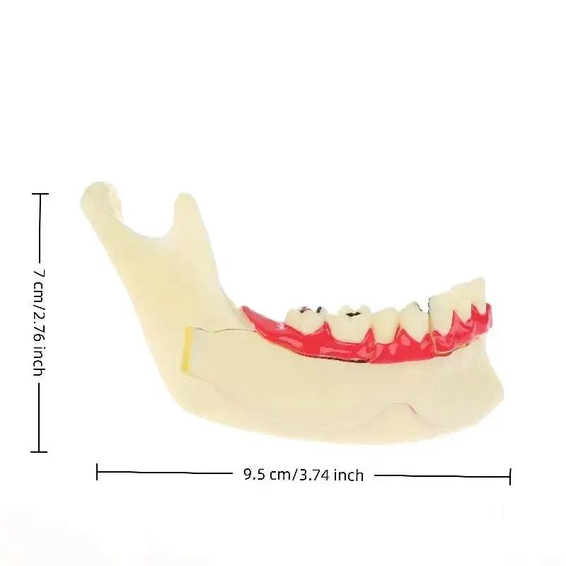  Dental Endodontic Gum Anatomy Model With Openable Gums -  ToylandEU™