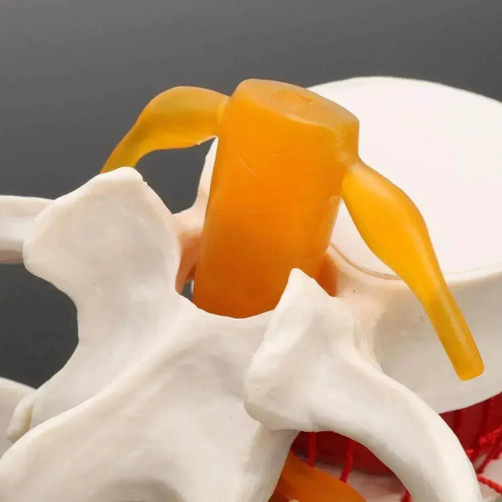  Human Anatomy Skeleton Spine Lumbar Disc Herniation Teaching Model Brain Skull Traumatic Pistol Medical School Supplies -  ToylandEU™