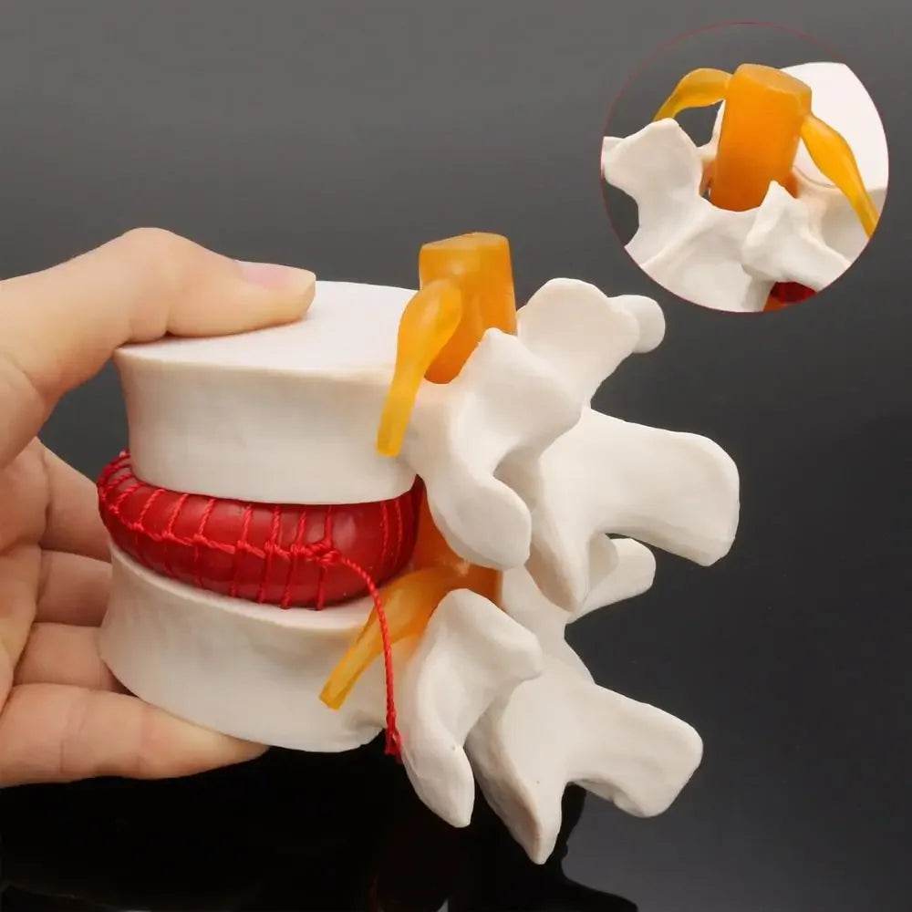 Human Anatomy Skeleton Spine Lumbar Disc Herniation Teaching Model Brain Skull Traumatic Pistol Medical School Supplies - ToylandEU
