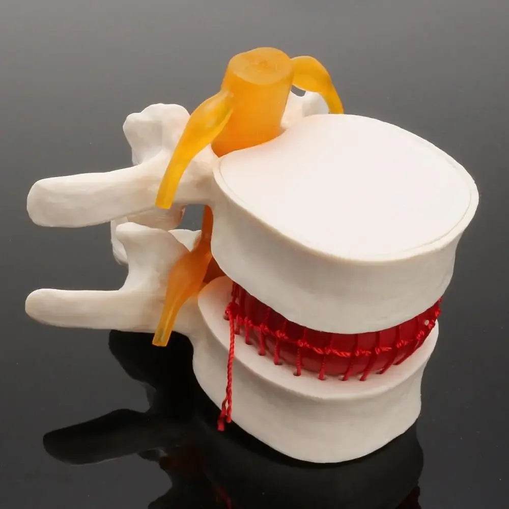 Human Anatomy Skeleton Spine Lumbar Disc Herniation Teaching Model Brain Skull Traumatic Pistol Medical School Supplies - ToylandEU