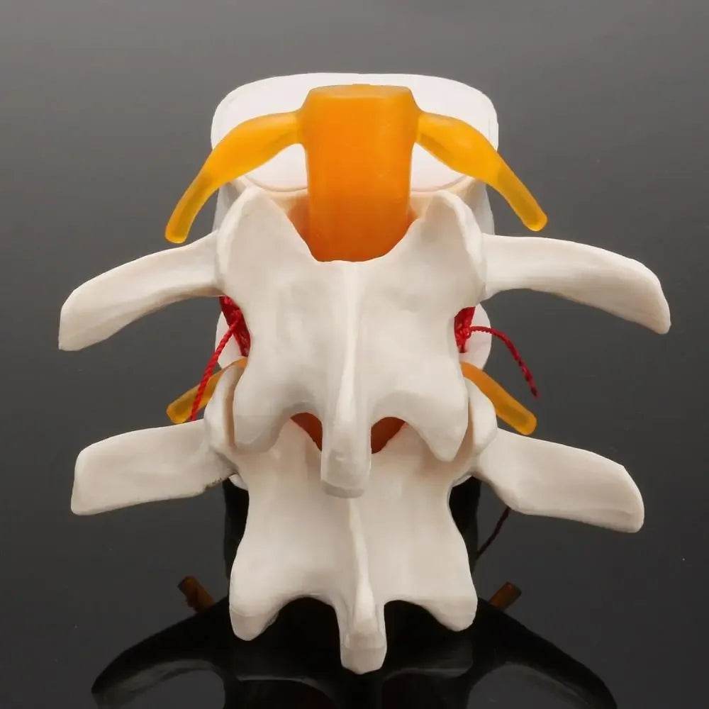 Human Anatomy Skeleton Spine Lumbar Disc Herniation Teaching Model Brain Skull Traumatic Pistol Medical School Supplies - ToylandEU