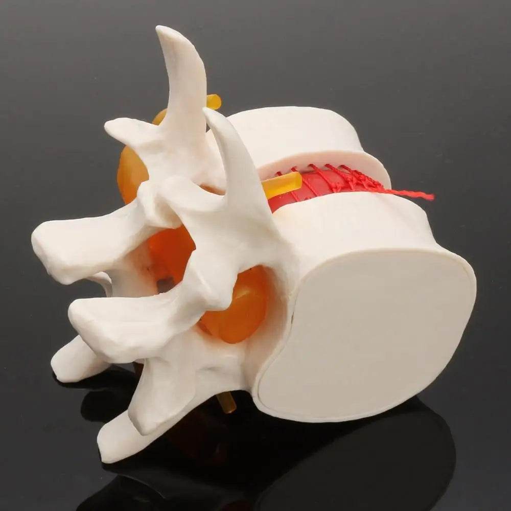 Human Anatomy Skeleton Spine Lumbar Disc Herniation Teaching Model Brain Skull Traumatic Pistol Medical School Supplies - ToylandEU