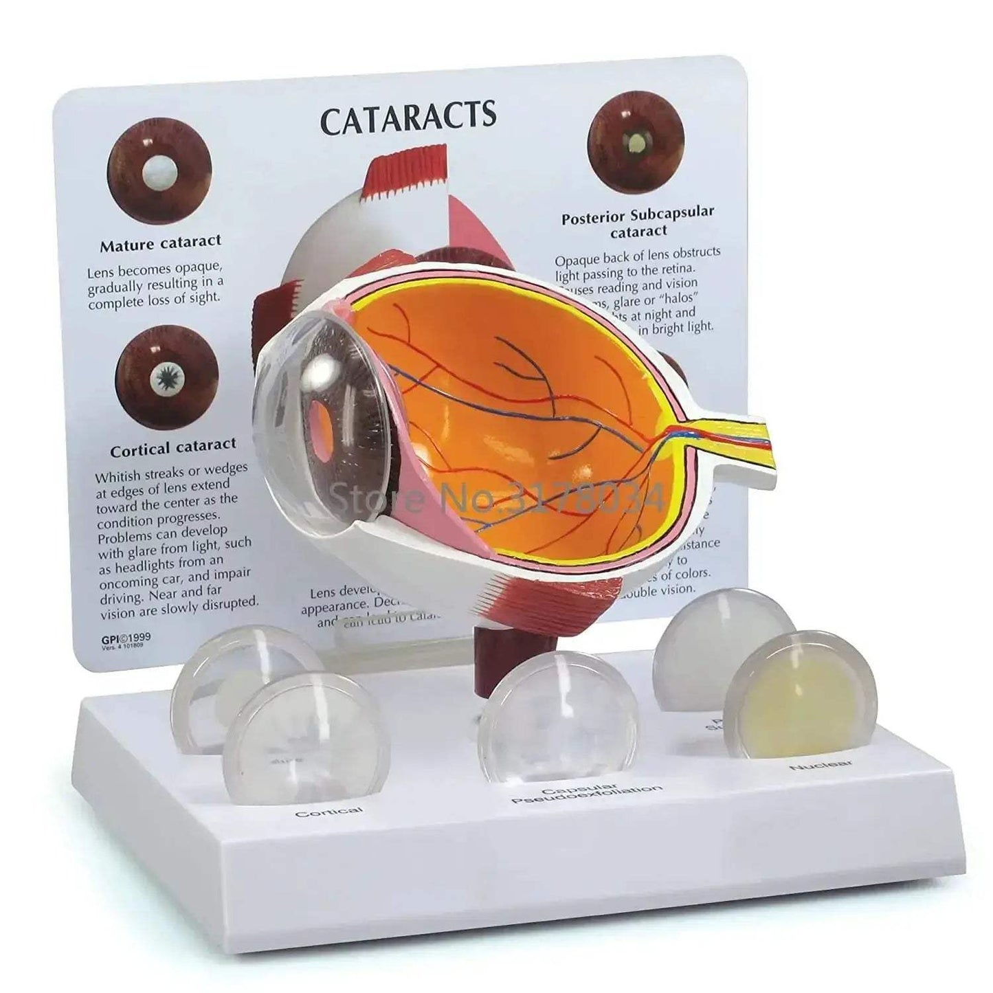 Human Eye Anatomical Model for Medical Education and Training - ToylandEU
