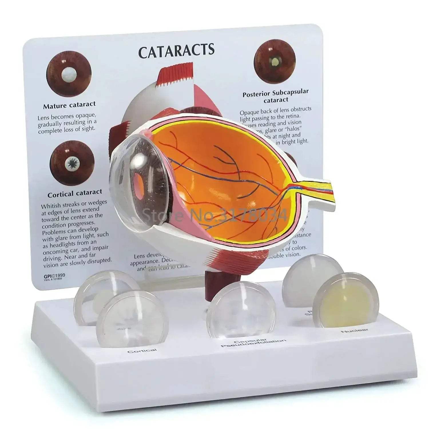 Human Eye Anatomical Model for Medical Education and Training - ToylandEU
