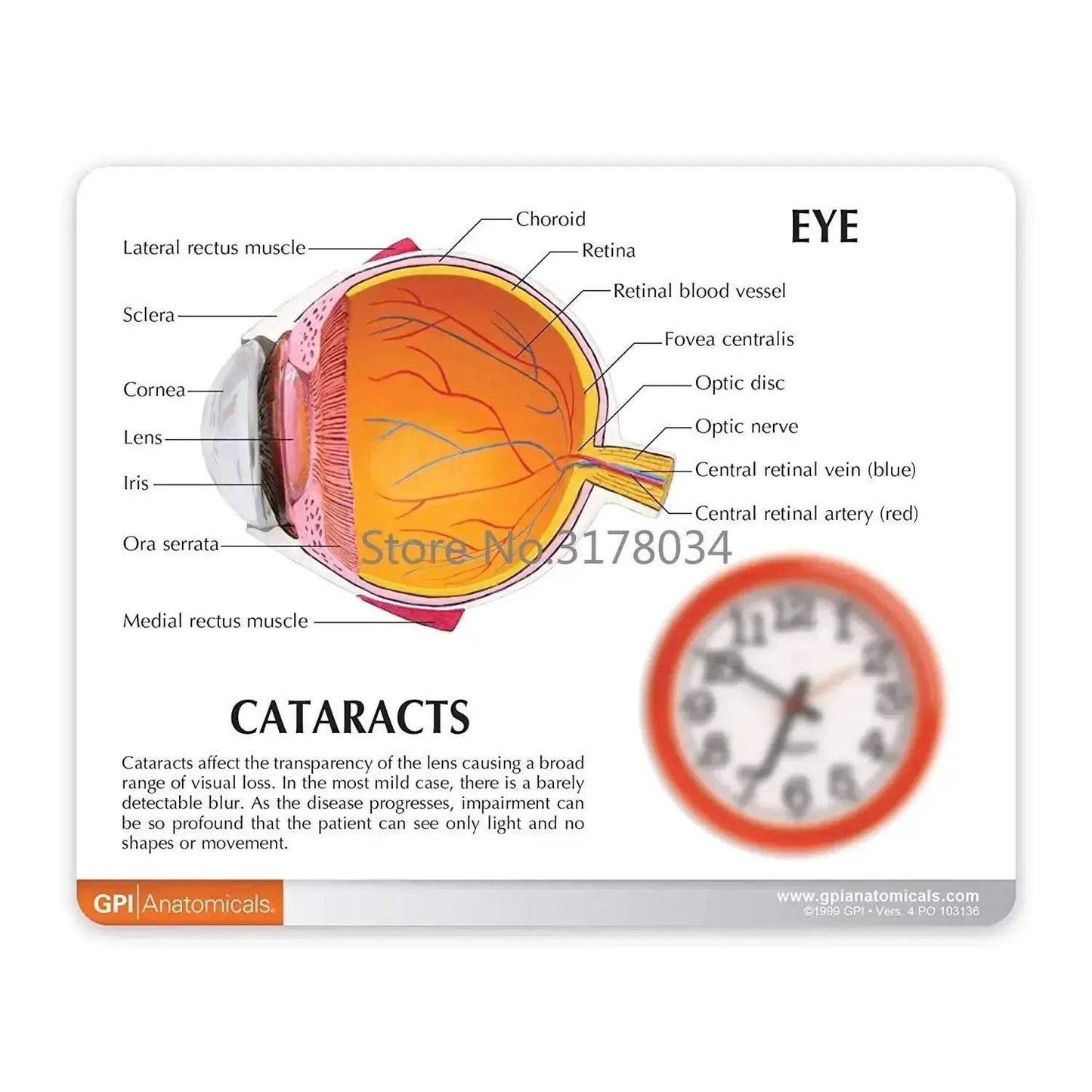 Human Eye Anatomical Model for Medical Education and Training - ToylandEU